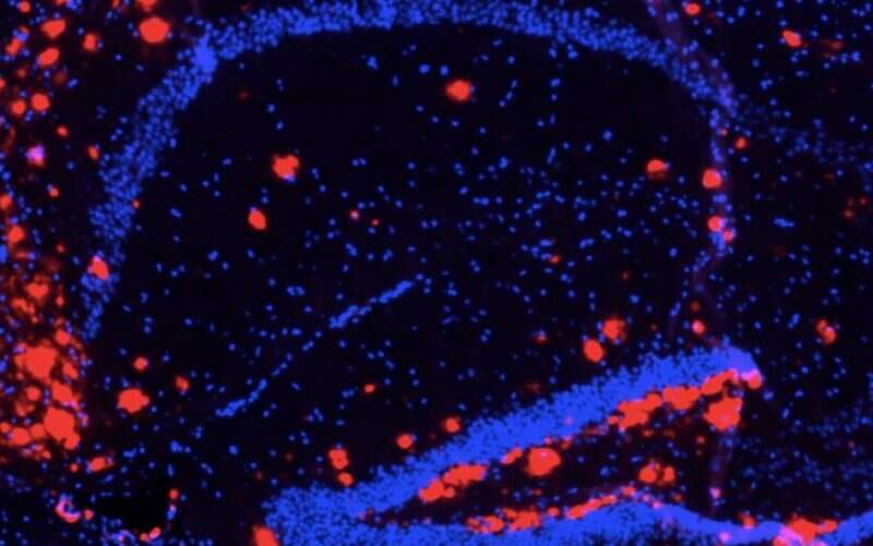 Pathway discovered that prevents buildup of Alzheimer’s Protein